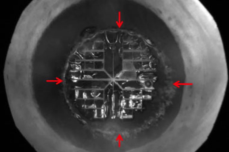 Femto Cataract