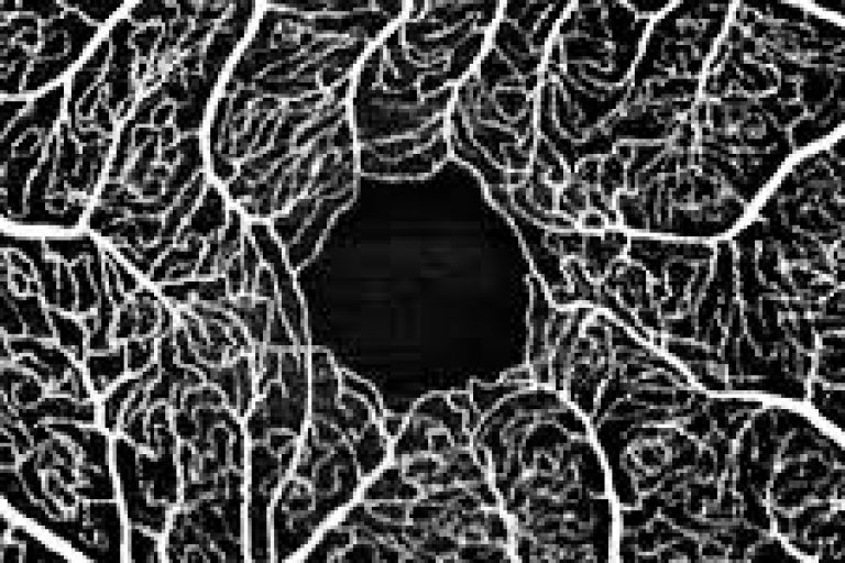 oct angiography